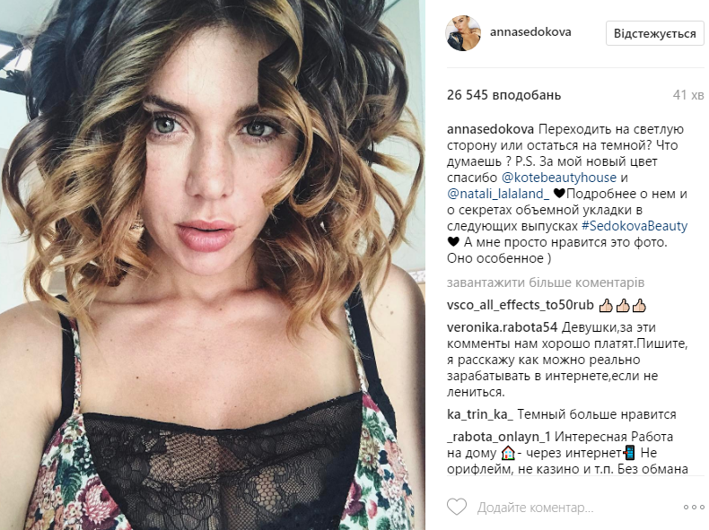 Анна Седокова удивила фанатов постаревшей внешностью